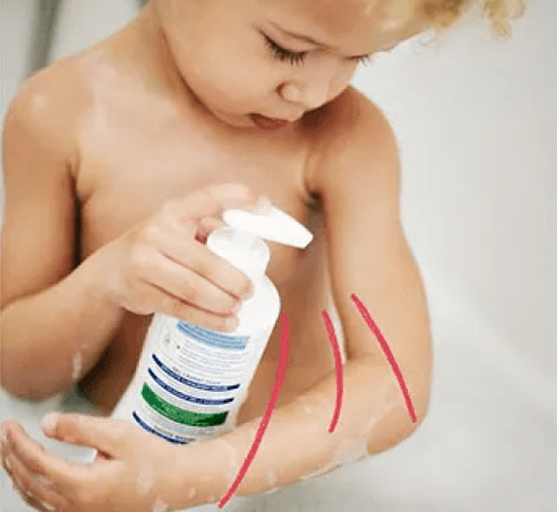 KUPANJE - Mustela Multi-market - 1